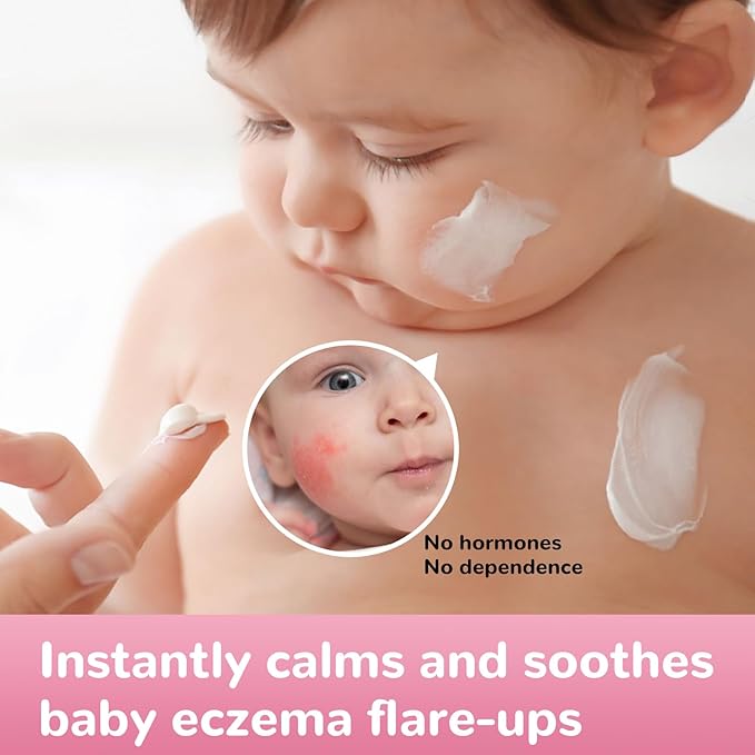 Baby Eczema Relief Cream, All-Natural Herbal Formula for Safe, Soothing Skin Protection Against Rashes, Dryness, Redness, and Itchiness, 3.53oz