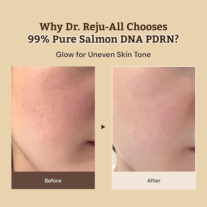 Dr. Reju-All Advanced PDRN Rejuvenating Cream – 99% Pure Salmon DNA PDRN Face Moisturizer – Optimal 1200ppm Concentration for Visible Results – Korean Anti-Aging Skin Care Face Cream - 0.7 Fl Oz