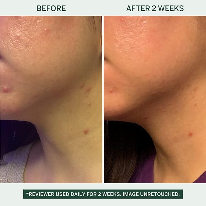FACETORY Urban Calm Barrier Cream Hydrating Face Moisturizer with Hyaluronic Acid & Fermented Honeybush, Daily Moisturizer Face Cream for Aging, Dry Skin & Sensitive Skin 1.69 Fl Oz