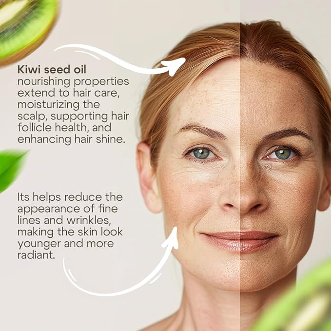 Au Natural Organics Kiwi Seed Oil for Face, Skin, Hair, Scalp, Lip & Nails Care | Cold Pressed Skin Moisturizer Oil, Reduce Wrinkles, Large Pores, Acne, Dark Spots & Other Skin Blemishes 3.4 oz