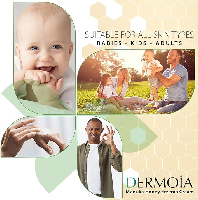 Manuka Honey Cream - Eczema Cream for Adults & Kids - Seborrheic Dermatitis Cream for All Skin Types - Eczema Honey Cream for Redness & Itch Skin Relief with Aloe Vera - 4oz