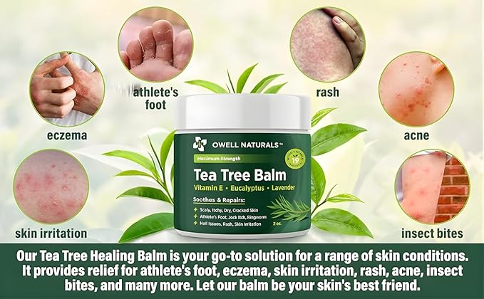 OWELL NATURALS Tea Tree Antifungal Balm – Soothing & Fast-Acting Relief for Athlete’s Foot, Jock Itch, Dry Cracked Skin, and Rashes – Natural Healing Ointment for Feet & Body, 2 oz