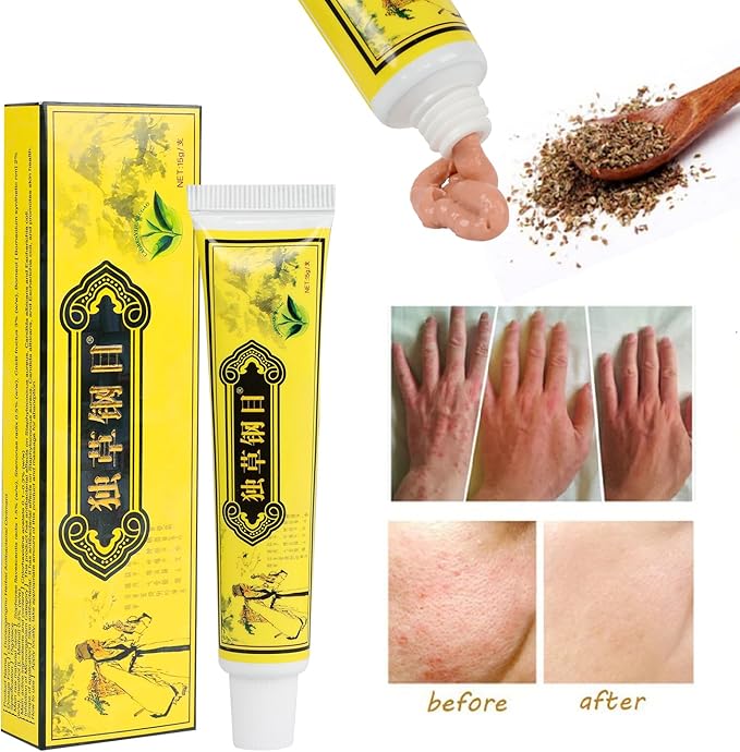 5Pcs Chinese Herbal Eczema Psoriasis Creams Dermatitis and Eczema Pruritus Psoriasis Ointment