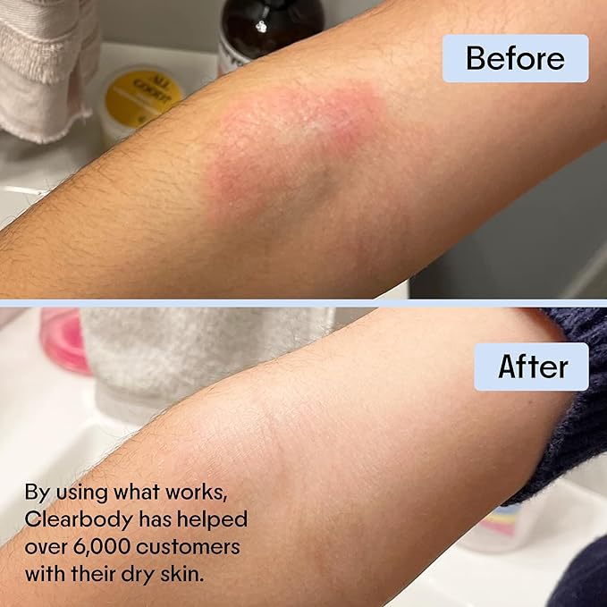 Clearbody Organics Oatmeal Lotion - 4 fl oz, Pack of 1 - Eczema Cream & Treatment - Natural Ointment for Eczema Manuka Honey Hydration Body Lotion