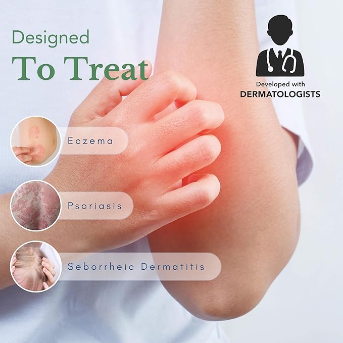 Theraplex AIM - Anti Itch Cream (2 oz) – 1% hydrocortisone for Itchy Skin Relief, moisturizing Cream for Eczema, Seborrheic Dermatitis. Safe for Kids. Relieves Itchy Skin with Maximum Strength.