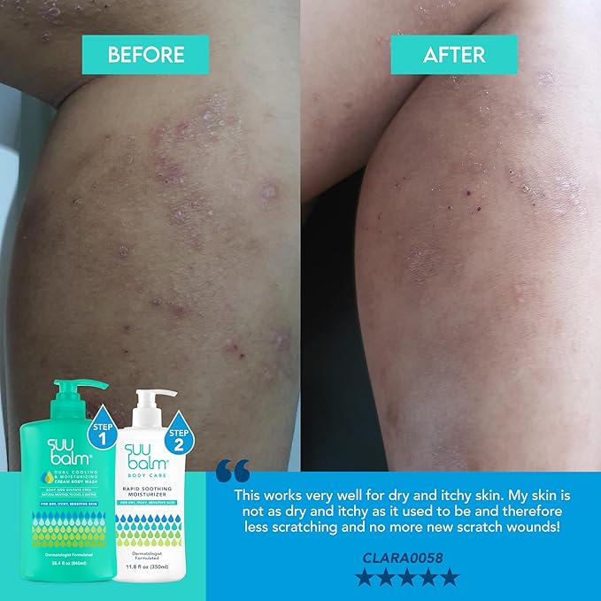 Suu Balm Intense Itch Relief Cream, Anti Itch Lotion for Sensitive Skin, Eczema, Psoriasis & Extreme, Very Severe & Dry Skin, Derm Formula, Menthol & Ceramides, 11.83 fl oz