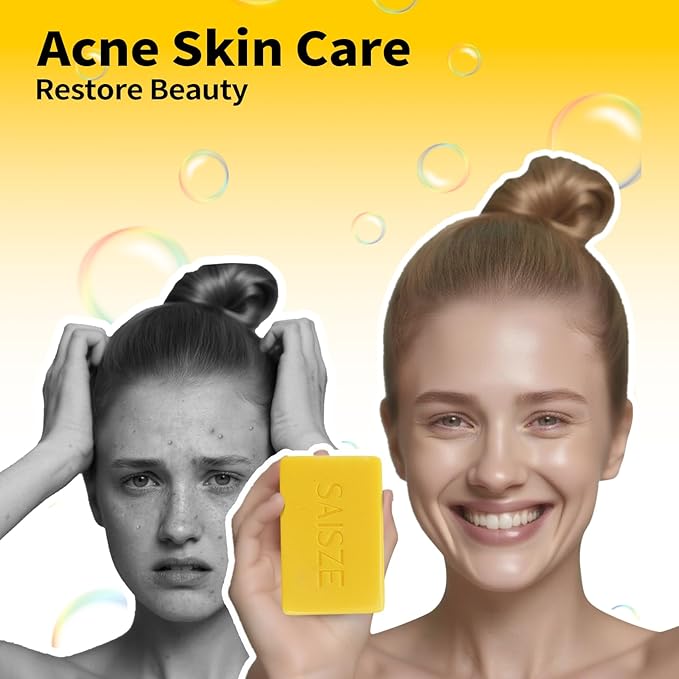 Sulfur Soap Bar Help with Acne and Blackheads, Natural Sulfur Face Wash Bar Keeps Pores Cleaner, Organic Sulphur Soap Bar for Oily Skin and Blemishes, 4 Ounce (Pack of 2)