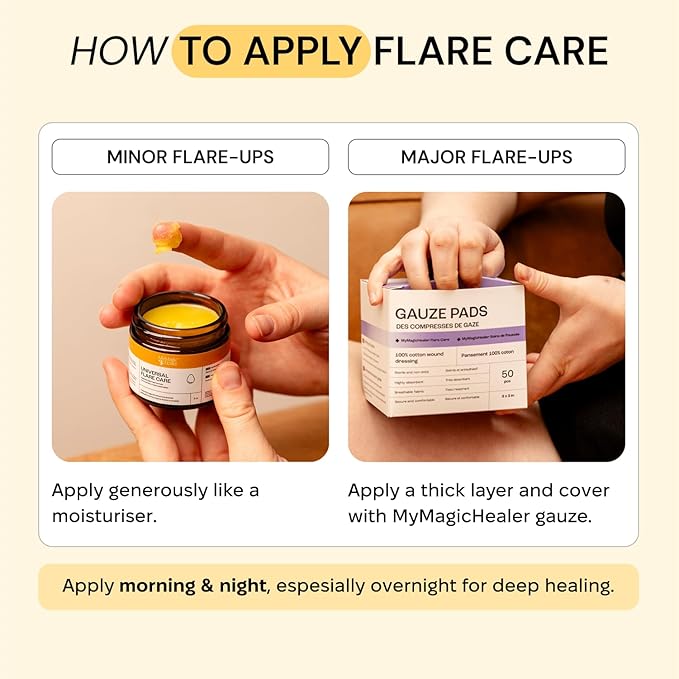 MyMagicHealer Universal Flare Care | Essential Oil Free | Relief for Rashes, Eczema, Psoriasis, Hidradenitis Suppurativa, Impetigo, Dermatitis, Wound Care, Sensitive Skin w/Propolis & Egg Yolk 2 oz