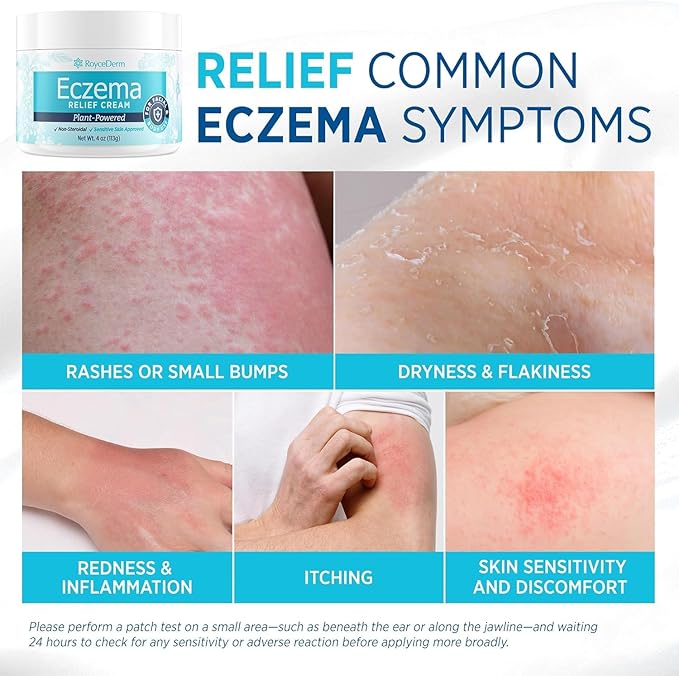 Roycederm Eczema & Psoriasis Cream for Dry, Itchy Skin – Moisturizer for Sensitive Skin, Eczema, Psoriasis & Dermatitis – 1% Colloidal Oatmeal + Ceramides – Steroid-Free for Adults, Kids & Babies