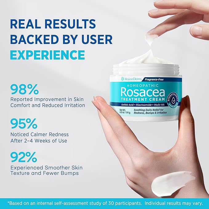 Roycederm Rosacea Treatment for Face with Azelaic Acid – Redness Relief & Corrector – Sensitive Skin Moisturizer for Redness, Bumps & Irritation with & Sulphur, Niacinamide, Centella & Ceramides