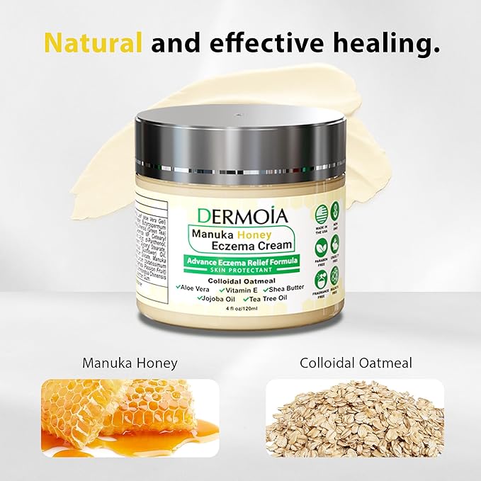 Manuka Honey Cream - Eczema Cream for Adults & Kids - Seborrheic Dermatitis Cream for All Skin Types - Eczema Honey Cream for Redness & Itch Skin Relief with Aloe Vera - 4oz