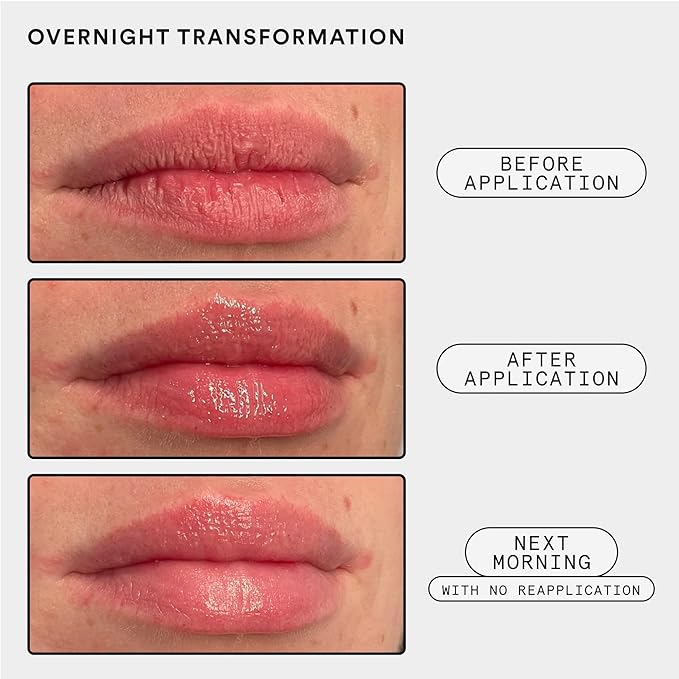 Experiment Softwear Smoothing Lip Treatment - 24hr Hydration with Squalane, Glycerin & Pomegranate Sterols - Intensive Moisture & Repair for Extra Dry, Flaky Lips - Vegan Lip Balm, .34 FL OZ