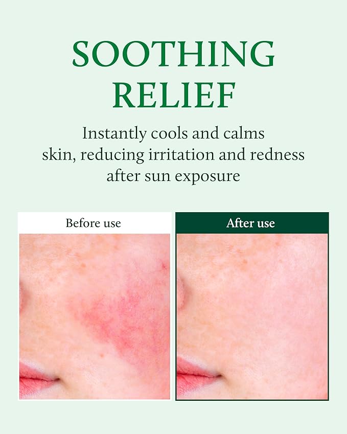 YADAH Cactus Soothing Gel (16.9fl oz) - 95% Cactus Extract, Sunburn Relief, Calm, Cool & Soothe Irritated Skin, Face Redness. Korean Skin Care, Vegan.