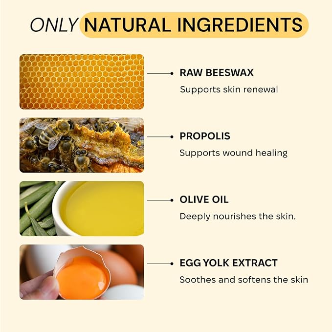 MyMagicHealer Universal Flare Care | Essential Oil Free | Relief for Rashes, Eczema, Psoriasis, Hidradenitis Suppurativa, Impetigo, Dermatitis, Wound Care, Sensitive Skin w/Propolis & Egg Yolk 2 oz