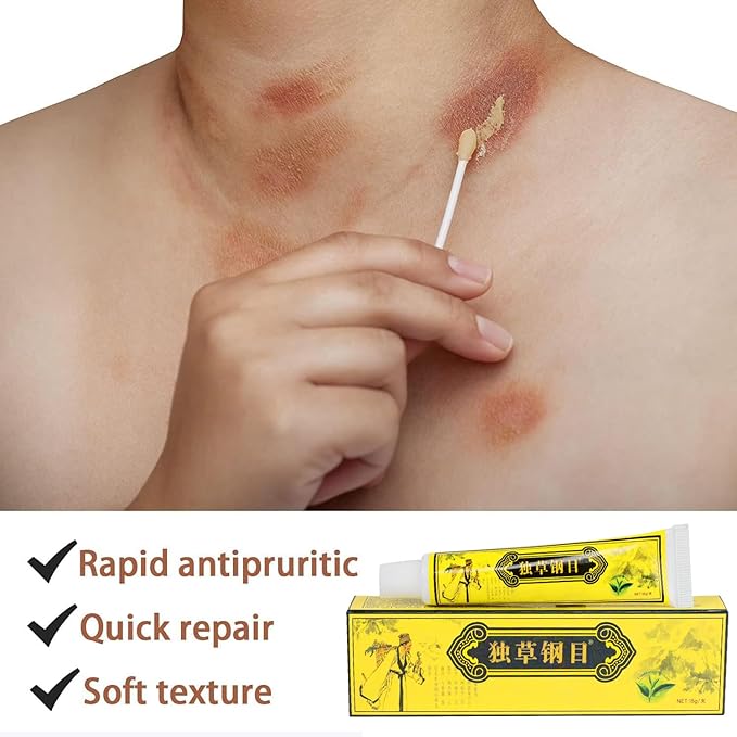 5Pcs Chinese Herbal Eczema Psoriasis Creams Dermatitis and Eczema Pruritus Psoriasis Ointment