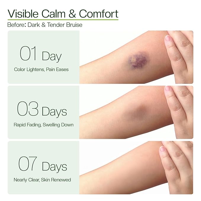 Morovan Helichrysum Balm 1.7 oz: Multi-Purpose Skin Cream for Bruises, Veins, Burns & Redness from Activity & Aging, Promotes Healing & Circulation for Men & Women