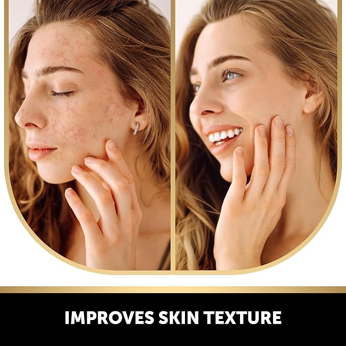 VALITIC 4 Pack Kojic Acid Vitamin C & Retinol Soap Bars for Dark Spot Bundle with 2 Black Exfoliating Gloves for Body Scrubs