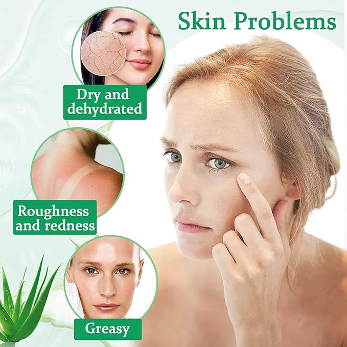 8PCS Aloe Vera Gel for Face & Skin,Organic Aloe Vera Gel,Hydrating After Sun Cream for Travel Size,Moisturizing Lotion for Skincare,After Sun Lotion for All Skin Type(J)