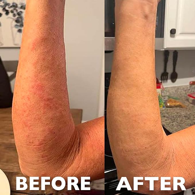 Hey Honey Skincare 911 Multipurpose Healing Ointment for Burns & Irritated Skin Instant Relief | Organic Propolis & Honey Extracts | Designed To Treat & Repair Compromised Skin, 99% Natural | 1 Oz
