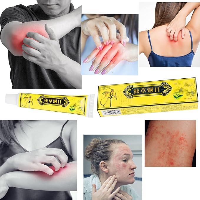 5Pcs Chinese Herbal Eczema Psoriasis Creams Dermatitis and Eczema Pruritus Psoriasis Ointment