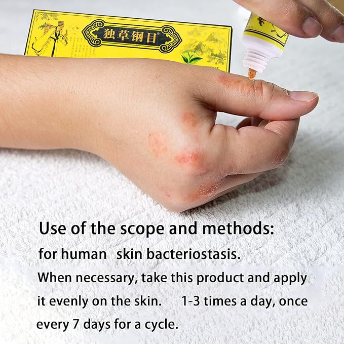 5Pcs Chinese Herbal Eczema Psoriasis Creams Dermatitis and Eczema Pruritus Psoriasis Ointment