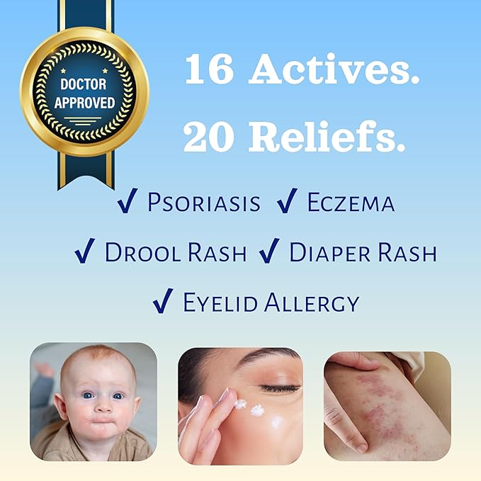 Natural SKIN REPAIR. Clinically tested Aromatherapy. Powerful Essential Oil. Eczema, Dermatitis, Diaper rash, and Sensitive skin. For all skin types. Hypoallergenic, Vegan, Paraben Free. 30ml BOTTLE