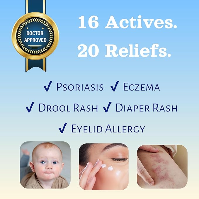 Natural SKIN REPAIR. Clinically tested Aromatherapy. Powerful Essential Oil. Eczema, Dermatitis, Diaper rash, and Sensitive skin. For all skin types. Hypoallergenic, Vegan, Paraben Free. 30ML TUBE