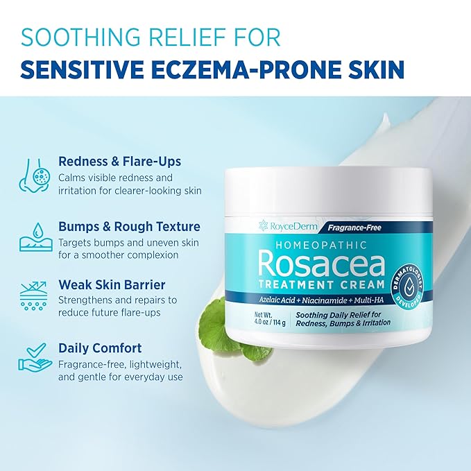 Roycederm Rosacea Treatment for Face with Azelaic Acid – Redness Relief & Corrector – Sensitive Skin Moisturizer for Redness, Bumps & Irritation with & Sulphur, Niacinamide, Centella & Ceramides