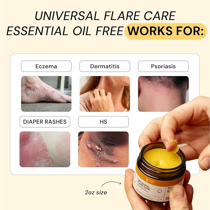 MyMagicHealer Universal Flare Care | Essential Oil Free | Relief for Rashes, Eczema, Psoriasis, Hidradenitis Suppurativa, Impetigo, Dermatitis, Wound Care, Sensitive Skin w/Propolis & Egg Yolk 2 oz