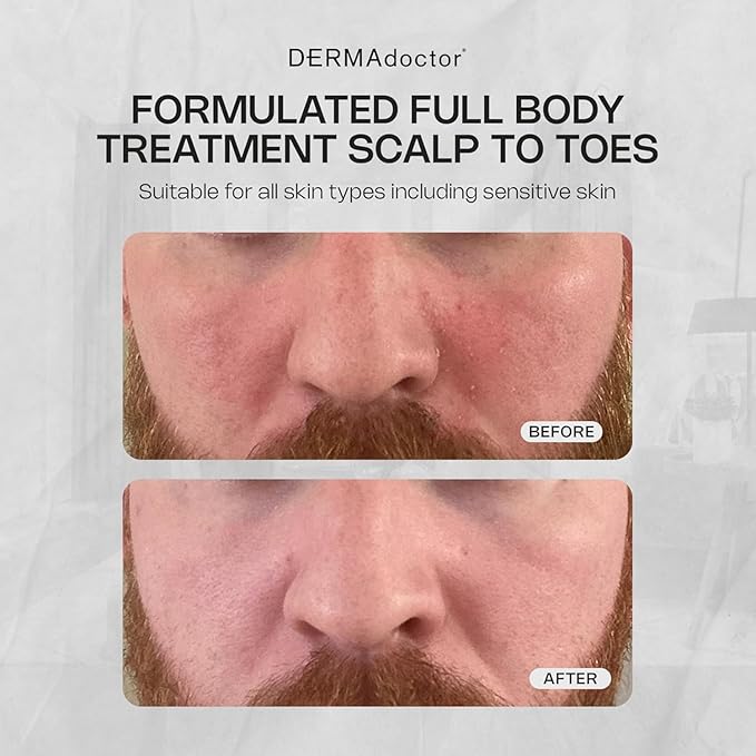 DERMAdoctor Tranquility Cleanser Dermatologist Formulated 2% Pyrithione Zinc for face body & Scalp - 7.10 oz