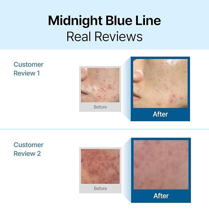 DearKlairs Midnight Blue Calming Cream – Soothing Face Moisturizer for Oily & Sensitive Skin, Redness Relief & Hydrating, Lightweight Texture, 1.05 Fl Oz