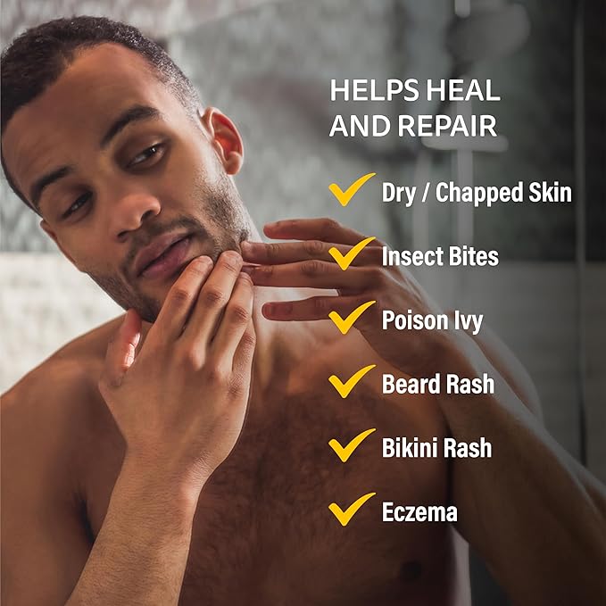 A+D Medicated Rash Ointment 1.5 oz– Relieves Rash & Skin Irritated Skin from Poison Ivy, Eczema, Beard Rash, Bikini Rash, Dry Skin, Chapped Skin, bug bites. Made with Colloidal Oatmeal