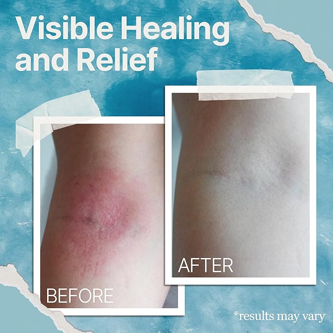 Natural & Soothing Eczema Cream - Hydrating & Nourishing Psoriasis Cream with Sea Moss & Colloidal Oatmeal - Quick Absorbing Anti Itch for Dry Sensitive Skin (4oz)