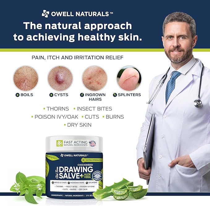 OWELL Naturals Chickweed Drawing Salve Aloe Vera, Multipurpose Ointment for Boil Removal, Bump, Cyst, Splinters, Poison Ivy, Skin Irritations, Burns, Minor Cuts, Dry Skin, Mosquito Itching, 2 oz