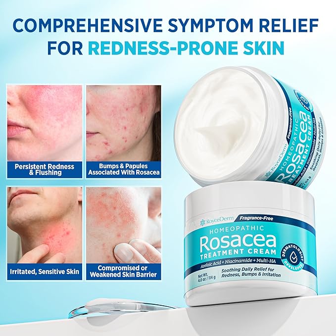 Roycederm Rosacea Treatment for Face with Azelaic Acid – Redness Relief & Corrector – Sensitive Skin Moisturizer for Redness, Bumps & Irritation with & Sulphur, Niacinamide, Centella & Ceramides