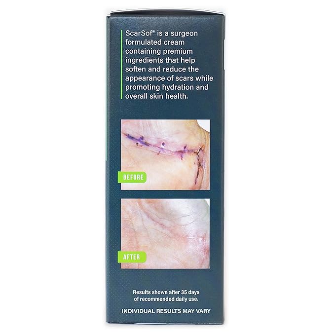 ScarSof Scar Cream - Advanced Scar Cream Made with 100% Organic Aloe Vera and All Natural Emu Oil - Helps Scar Appearance and Overall Skin Health - 4 oz
