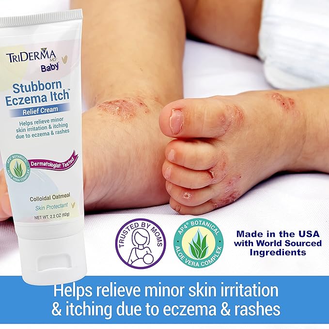 TriDerma Baby Stubborn Eczema Itch Relief Cream Soothing for Sensitive Skin 2.2 Ounces