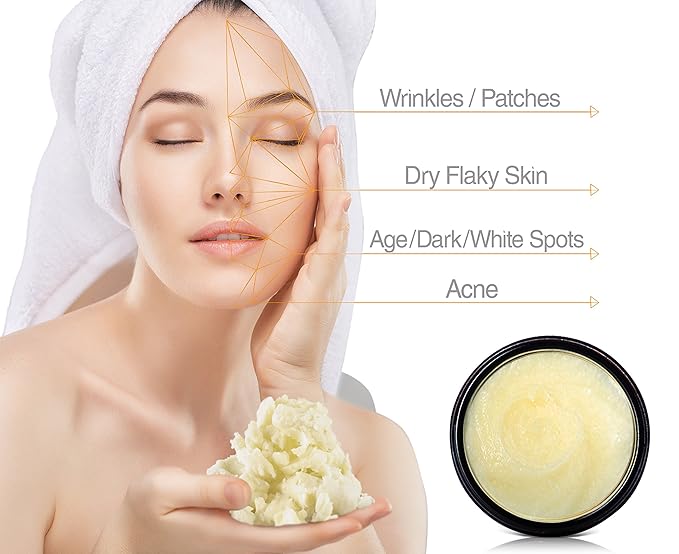Nilotica Shea Butter 9oz – Soothe Irritated Skin, Itchiness, Rashes, Redness, Dark Circles, 100% Organic Cold Pressed, Shea Nilotica East African Shea Butter, Whole Body Moisturizer, Creamy Smooth