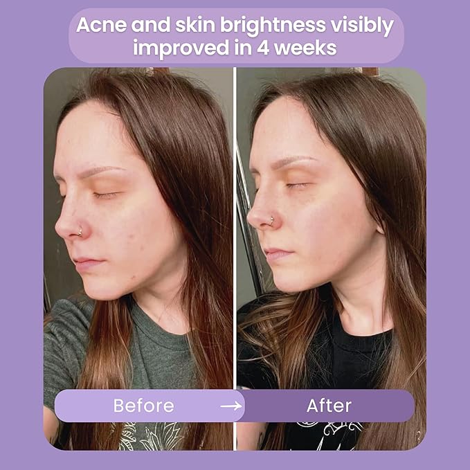 Infinite Aura Face Moisturizer – Facial Lotion for Women; Hyaluronic Acid + Ceramide Wrinkle Barrier Repair Cream, Beta-Glucan Redness Relief, Copper Peptide Firming Anti Aging Day-Night
