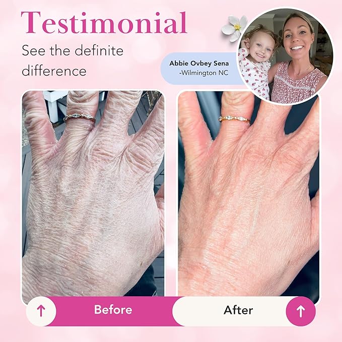 Theraplex Clear Emollient Lotion (8 oz) - No Parabens or Preservatives, Noncomedogenic and Hypoallergenic, Fragrance Free, Dermatologist recommended (1 Pack Lotion)