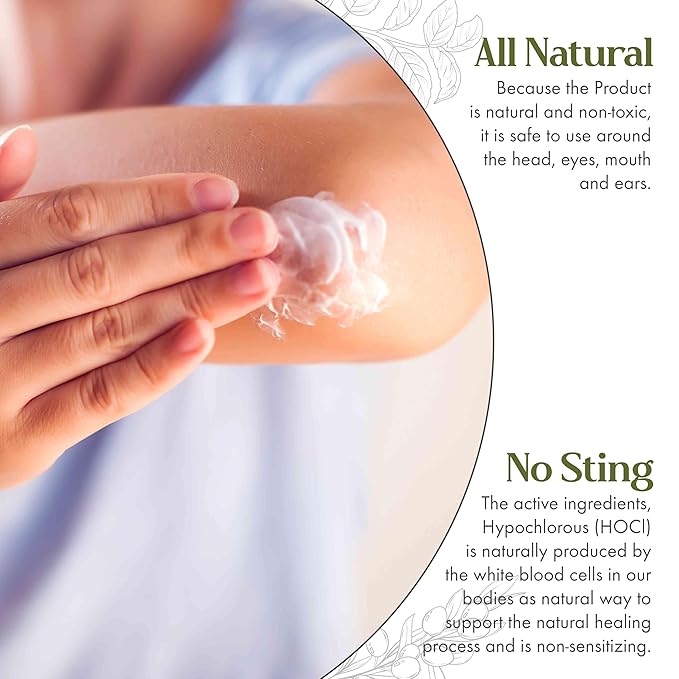 Skin Soothing Antiseptic Cream for Burns, Cuts, Blisters & Rashes, Restorative Wound Healing Balm with Aloe Vera, Beeswax & Olive Oil, Fast Relief Antiseptic Ointment Safe for All Skin Types, 50g Jar