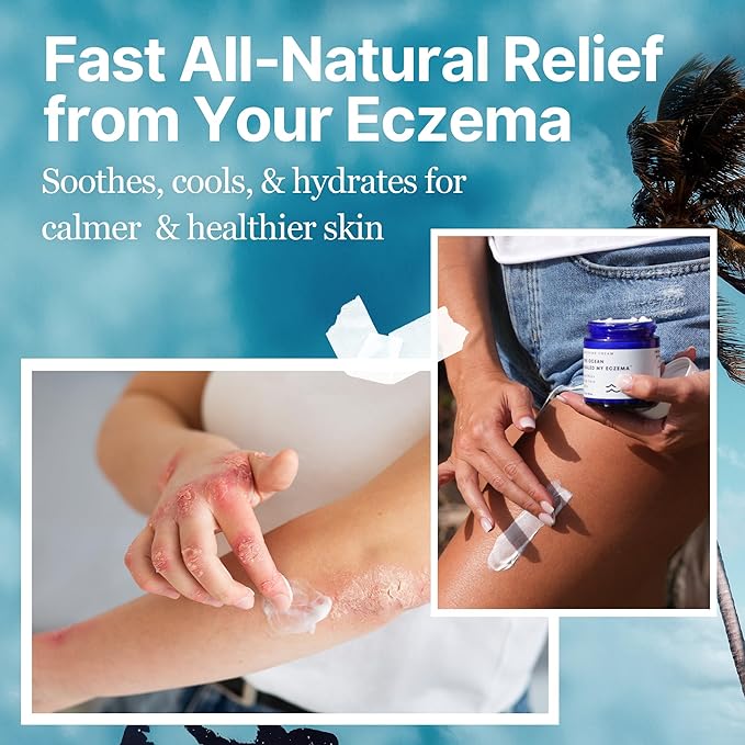 Natural & Soothing Eczema Cream - Hydrating & Nourishing Psoriasis Cream with Sea Moss & Colloidal Oatmeal - Quick Absorbing Anti Itch for Dry Sensitive Skin (4oz)
