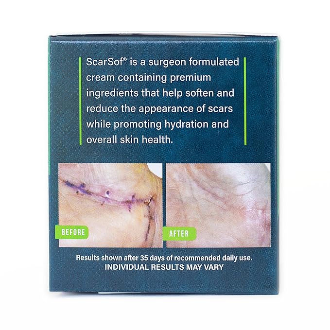 ScarSof Scar Cream - Advanced Scar Cream Made with 100% Organic Aloe Vera and All Natural Emu Oil - Helps Scar Appearance and Overall Skin Health - 2 oz